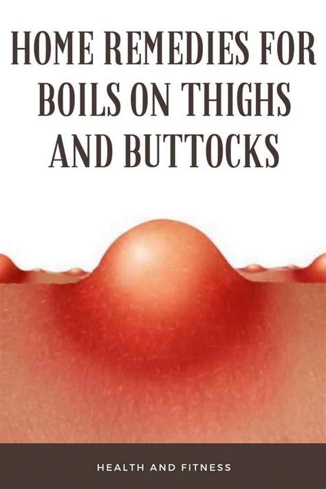 How to prevent boils on my inner thigh. Things To Know About How to prevent boils on my inner thigh. 